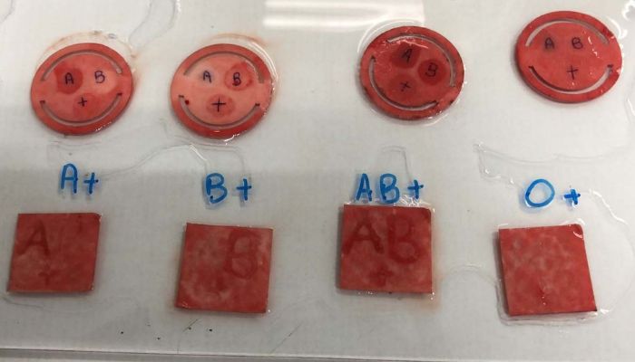  Apoio do Estado: curativo que identifica tipo sanguíneo em minutos passa por testes finais 